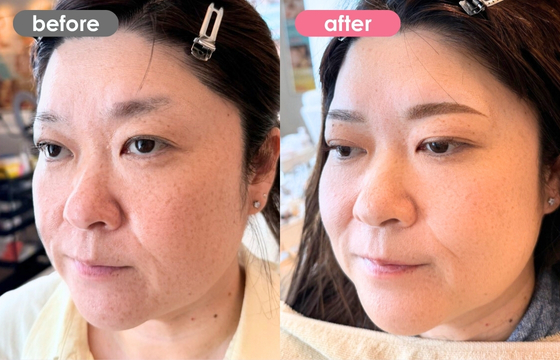 眉アートメイク-170 02