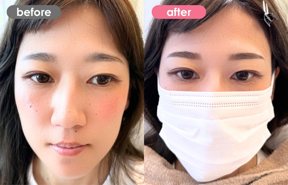 眉アートメイク-172