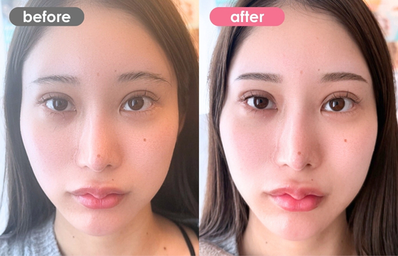 眉アートメイク-173 03