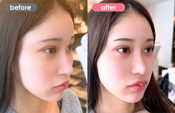 眉アートメイク-173