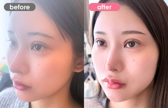 眉アートメイク-173 02