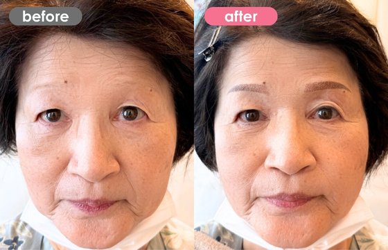 眉アートメイク-174 02