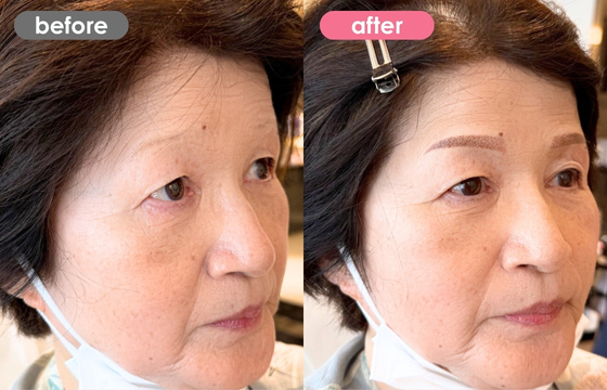 眉アートメイク-174 03