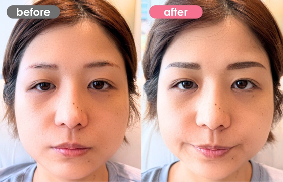 眉アートメイク-175 02