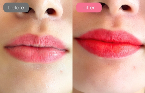 唇アートメイク-09