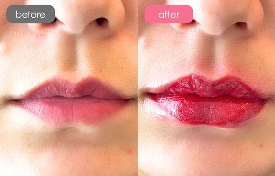 唇アートメイク-10