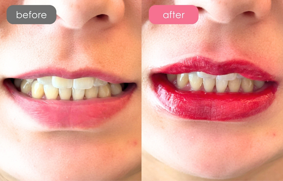 唇アートメイク-10 02