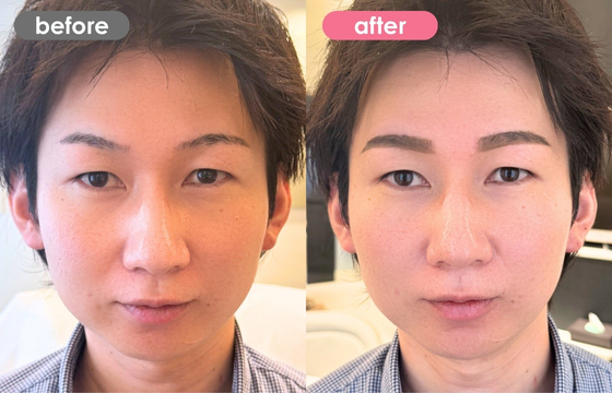 眉アートメイク(メンズ)29