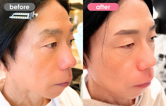 眉アートメイク(メンズ)30 03