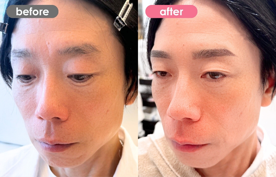 眉アートメイク(メンズ)30 02