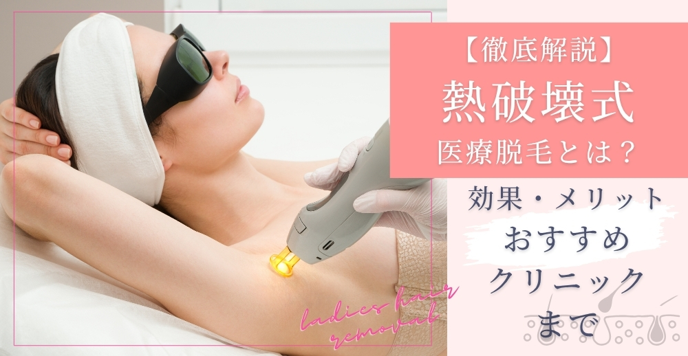 【徹底解説】熱破壊式医療脱毛とは？効果・メリット・おすすめクリニックまで