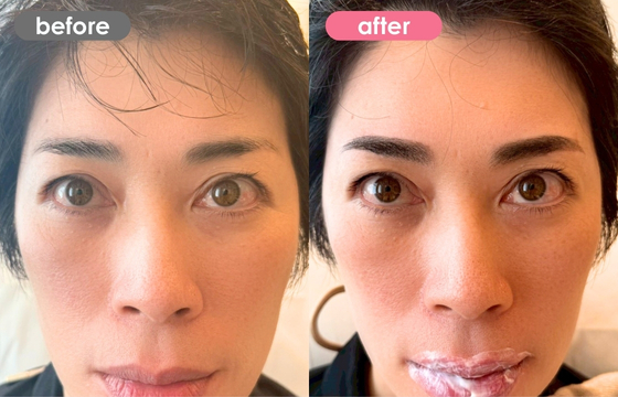 眉アートメイク-176 03