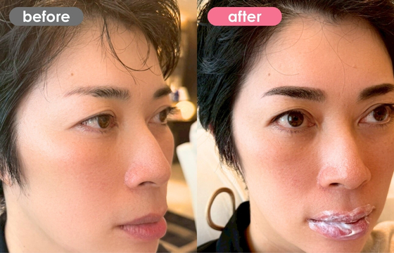 眉アートメイク-176 02