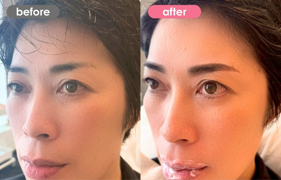 眉アートメイク-176