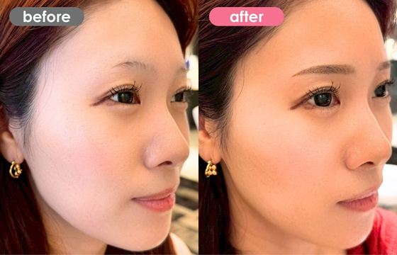 眉アートメイク-177 03