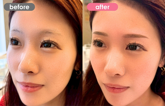 眉アートメイク-177 02