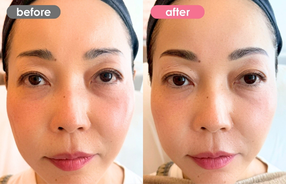 眉アートメイク-178 03