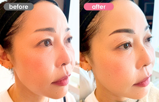 眉アートメイク-178 02