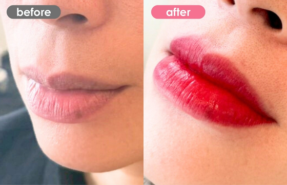 唇アートメイク-11