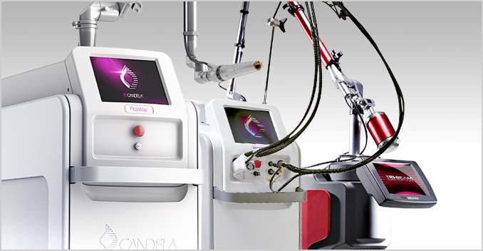 qスイッチレーザー ダウンタイム