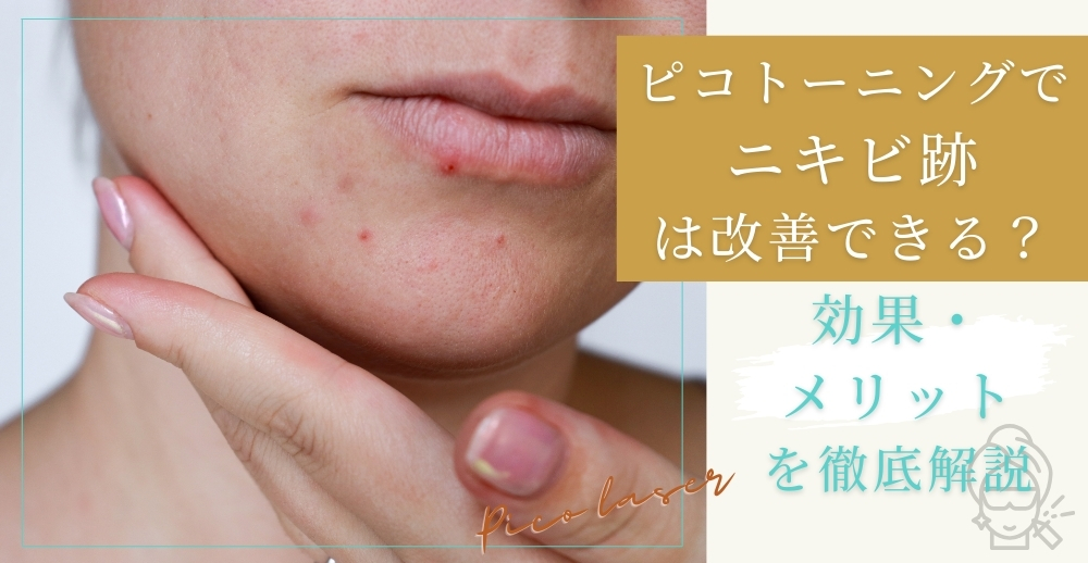 ピコトーニングでニキビ跡は改善できる？効果・メリットを徹底解説