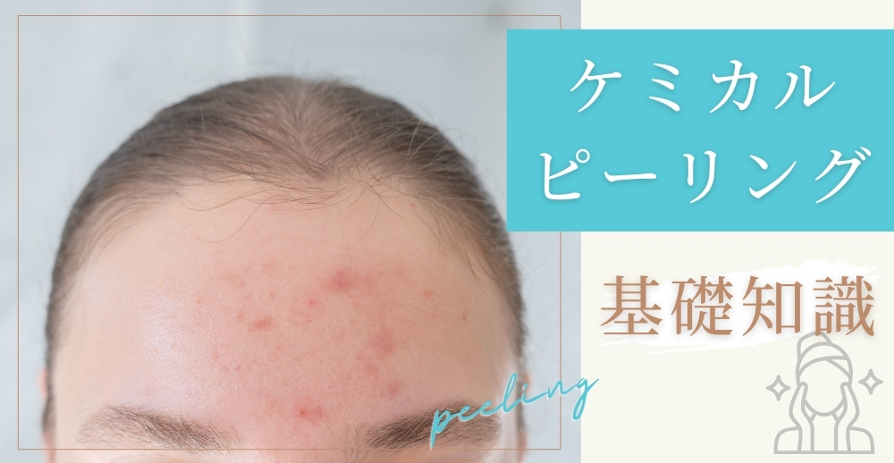 ケミカルピーリングの基礎知識