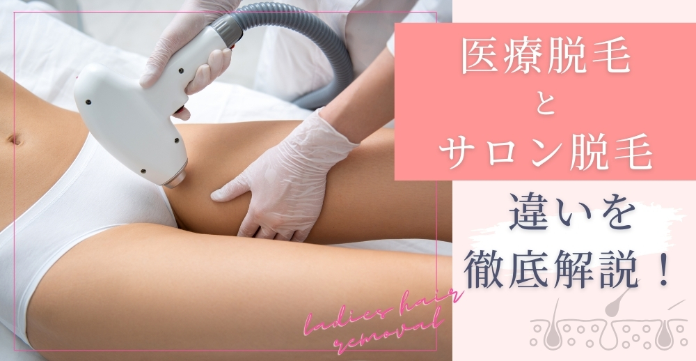 医療脱毛とサロン脱毛の違いを徹底解説！
