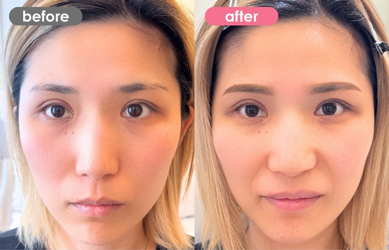 眉アートメイク-179