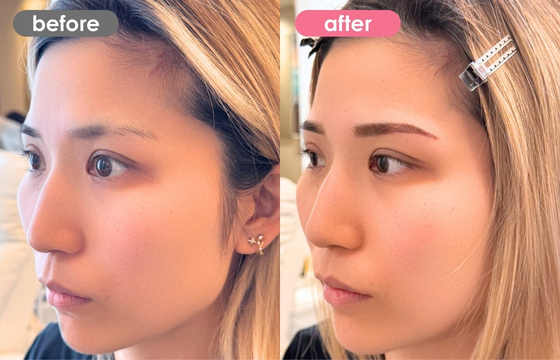 眉アートメイク-179 02