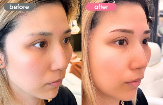 眉アートメイク-179 03