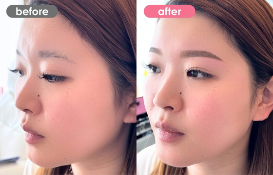 眉アートメイク-180 02