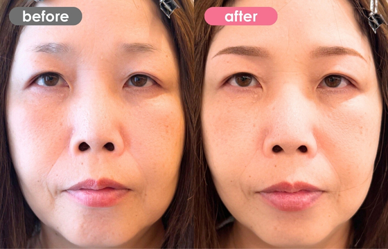 眉アートメイク-181