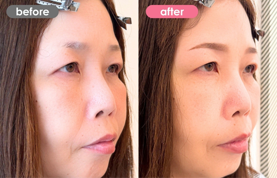 眉アートメイク-181 02