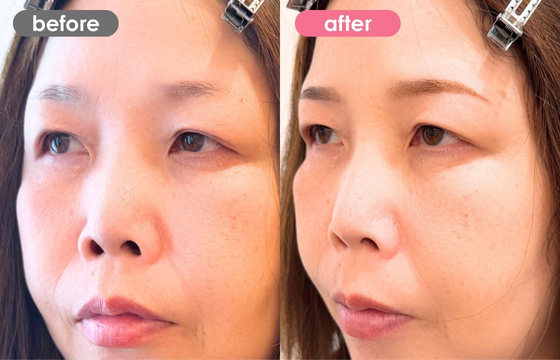 眉アートメイク-181 03