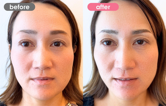 眉アートメイク-182