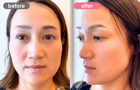 眉アートメイク-182 02