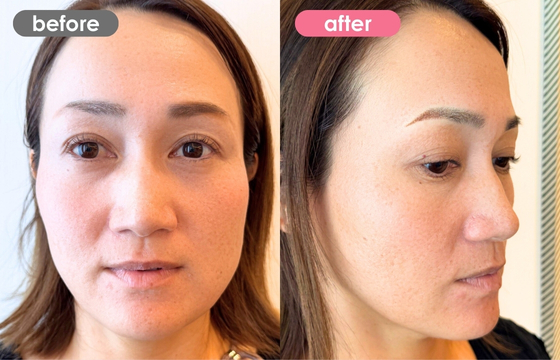 眉アートメイク-182 03