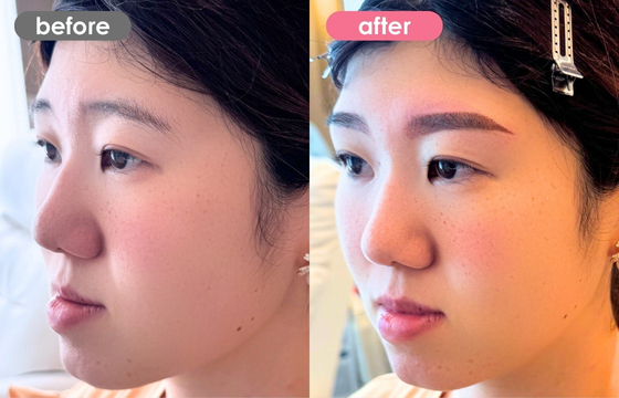 眉アートメイク-183 03