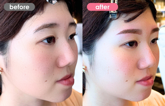 眉アートメイク-183 02