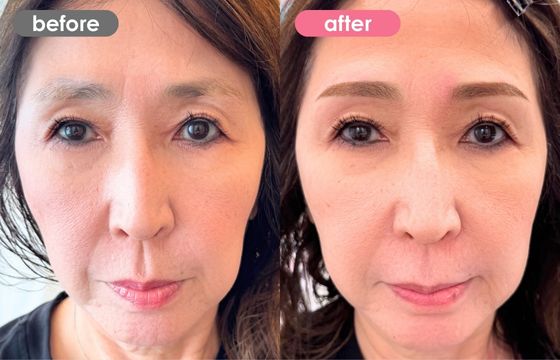 眉アートメイク-184