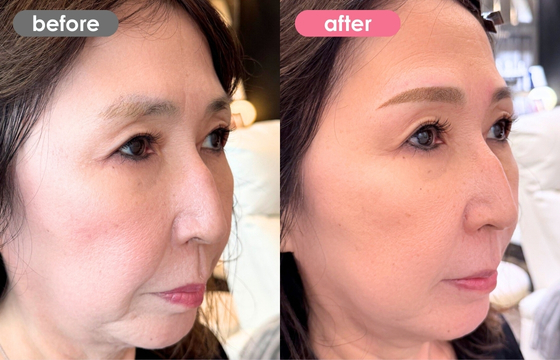 眉アートメイク-184 03