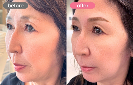 眉アートメイク-184 02