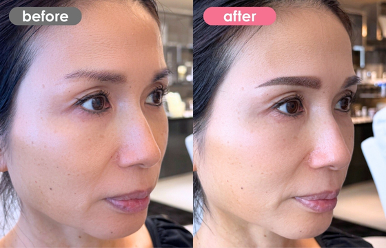 眉アートメイク-185 02