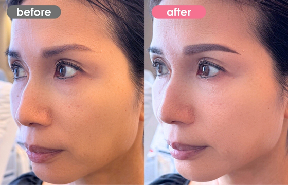 眉アートメイク-185 03