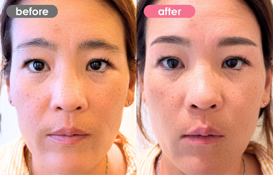 眉アートメイク-186