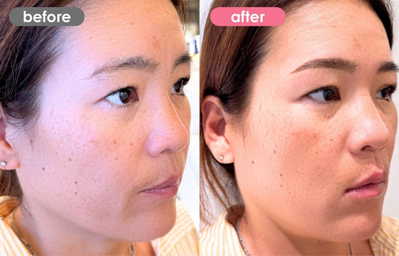 眉アートメイク-186 02