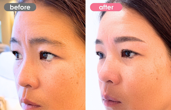 眉アートメイク-186 03