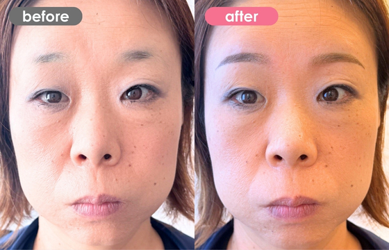 眉アートメイク-187