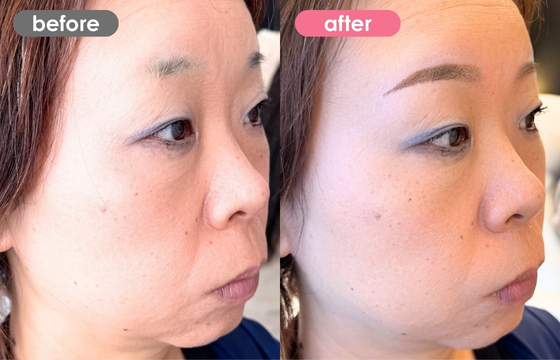 眉アートメイク-187 03