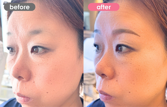 眉アートメイク-187 02